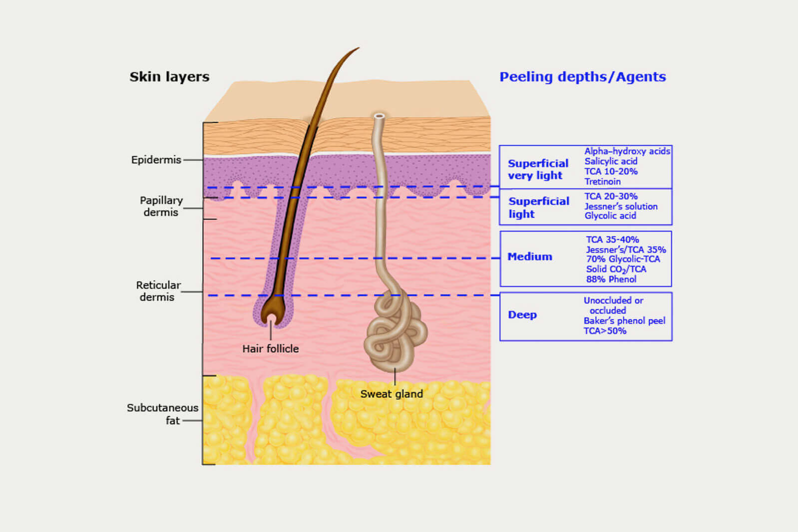 Chemical Peels - Haber Dermatology